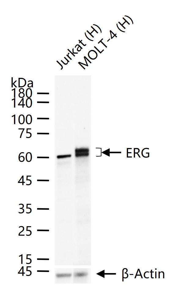 癌基因ERG重组兔单抗