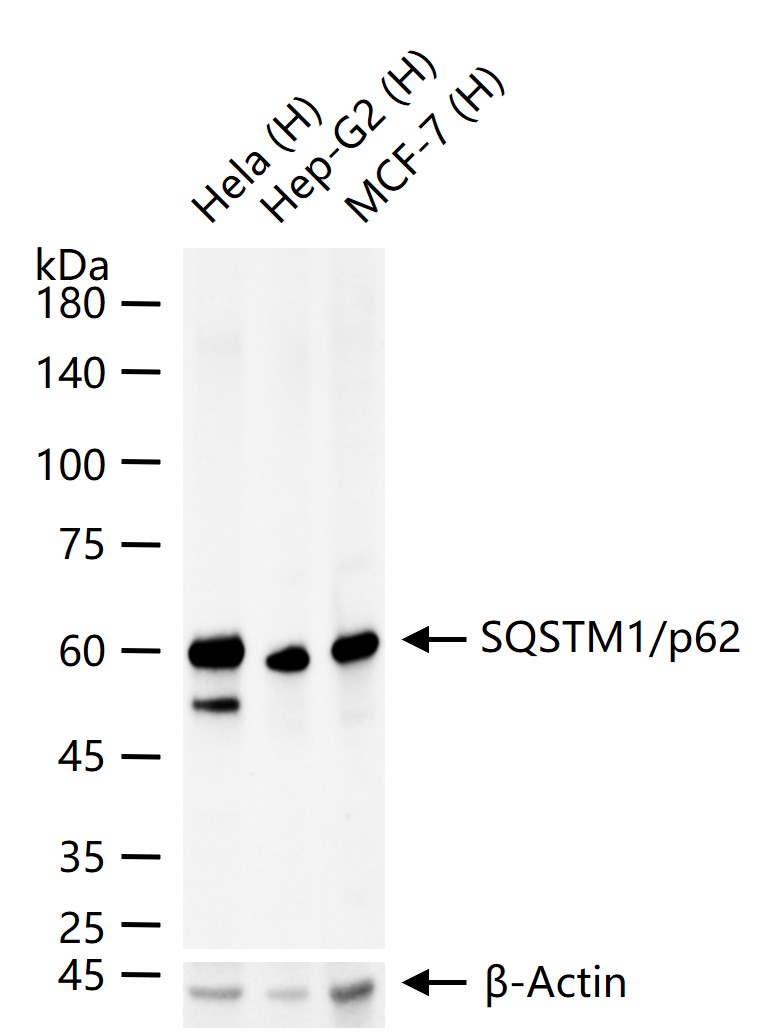 泛素结合蛋白P62重组兔单抗