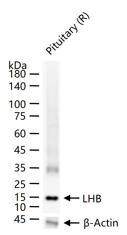 促黄体素β亚单位重组兔单抗