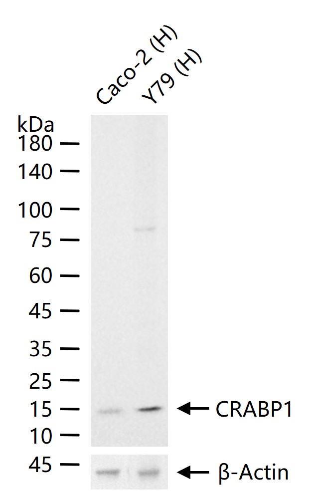 细胞维甲酸结合蛋白1重组兔单抗
