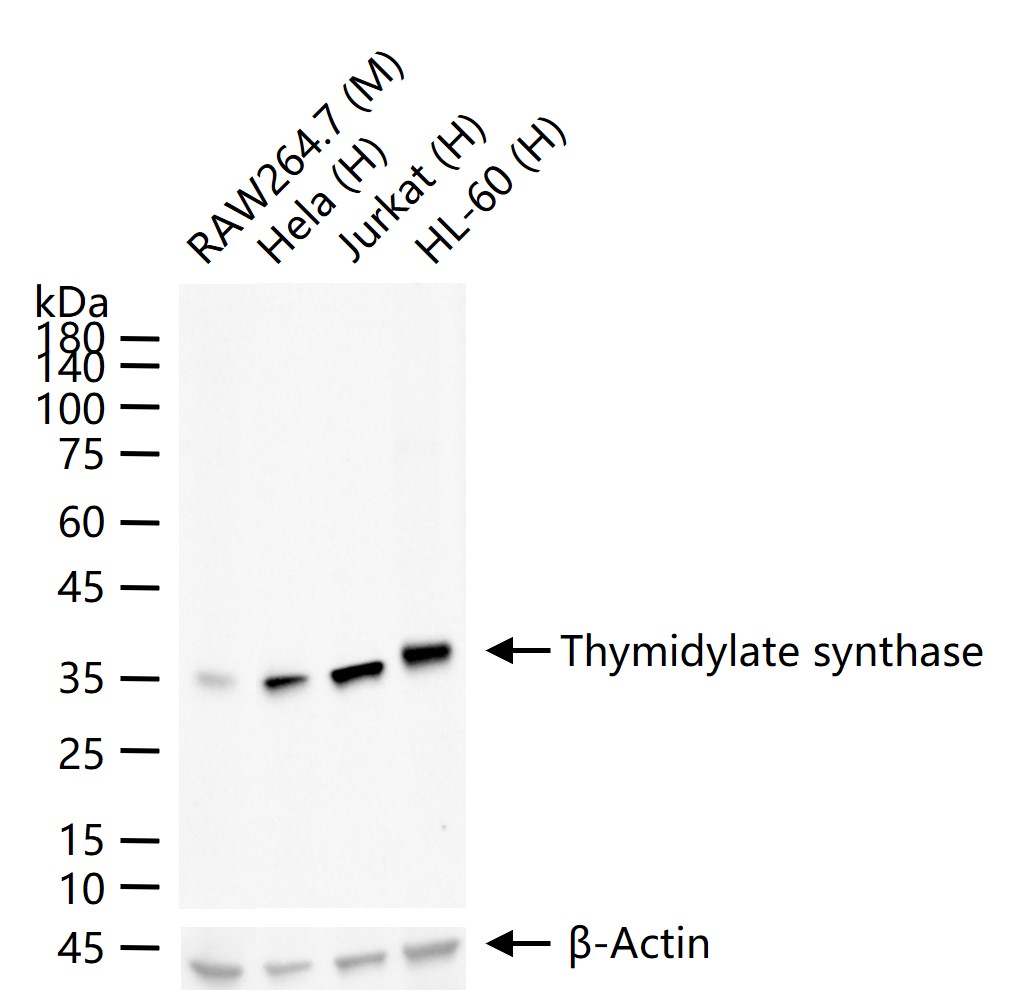 TYMS Recombinant Rabbit mAb (一抗) - WB,IHC-P,IHC-F,IF,Flow-Cyt,ICC/IF | Bioss
