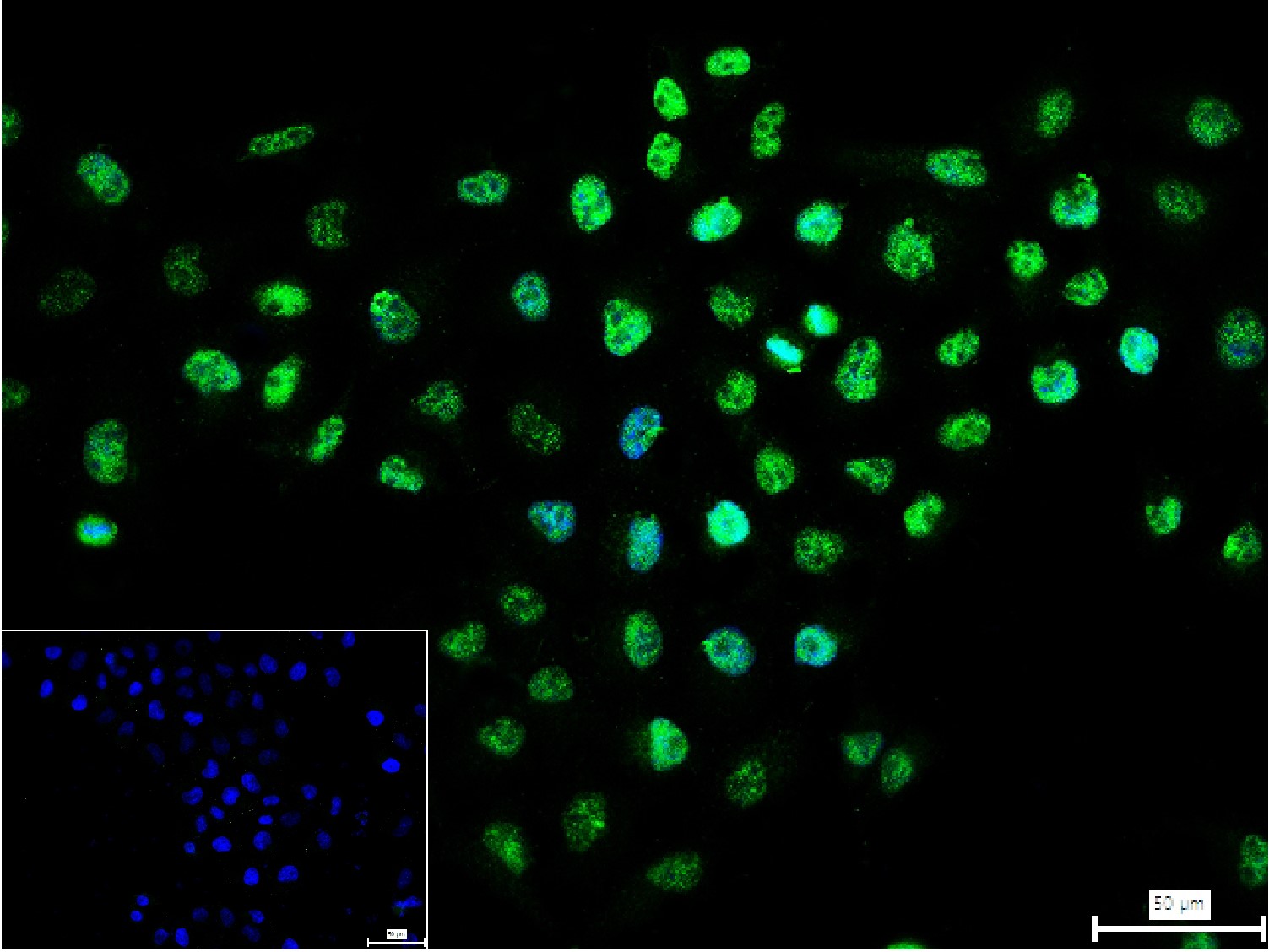 受体激活蛋白激酶C1重组兔单抗