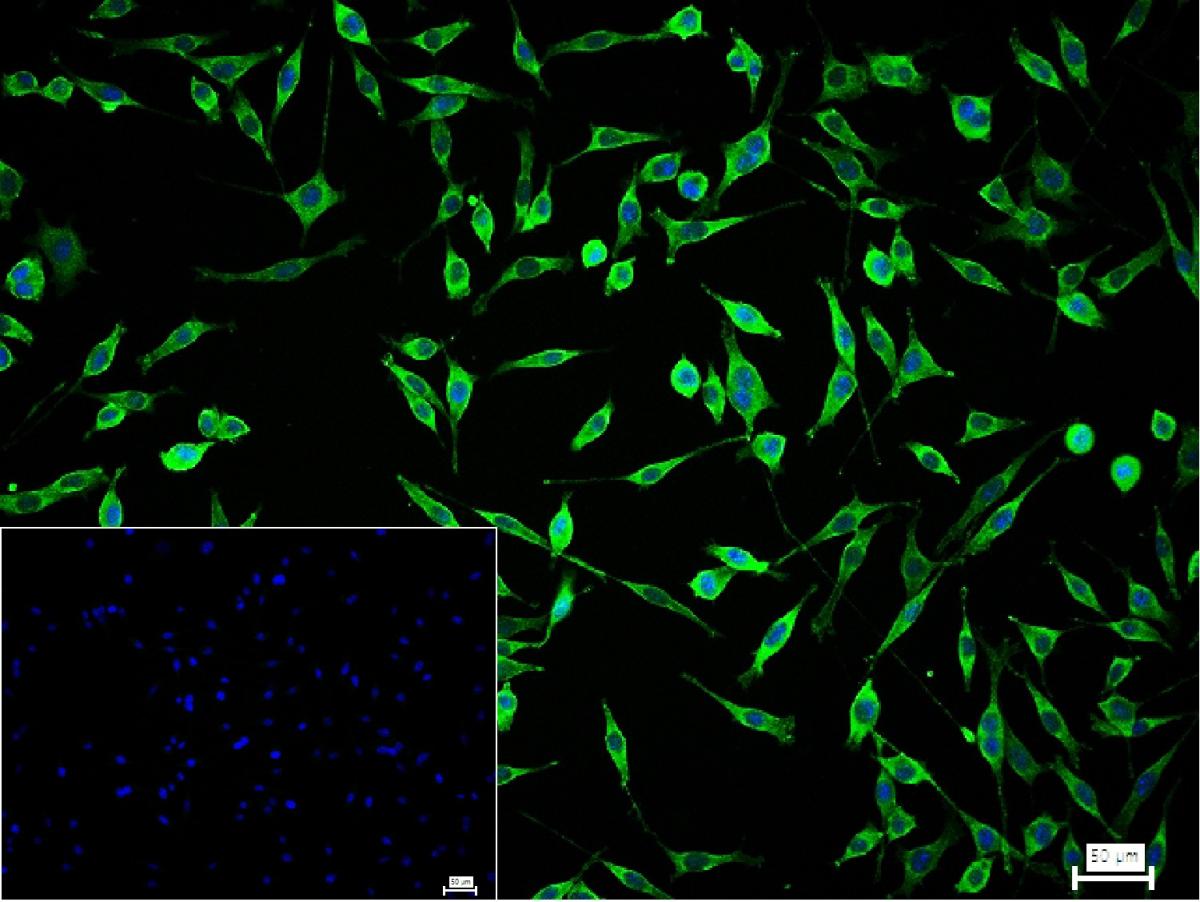 过氧化物还原酶6重组兔单抗