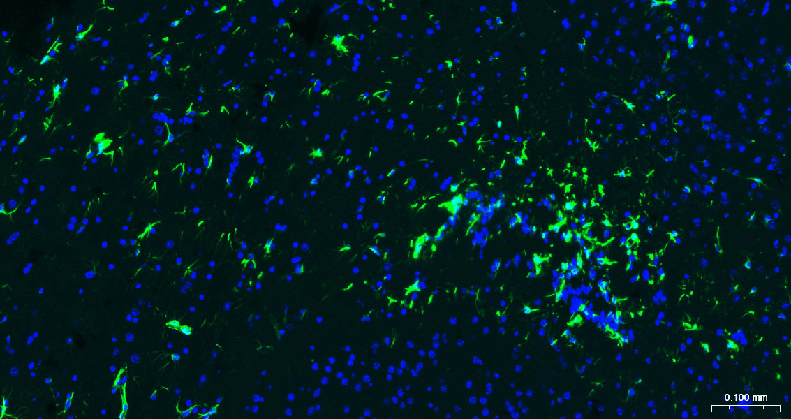 胶质纤维酸性蛋白重组兔单抗