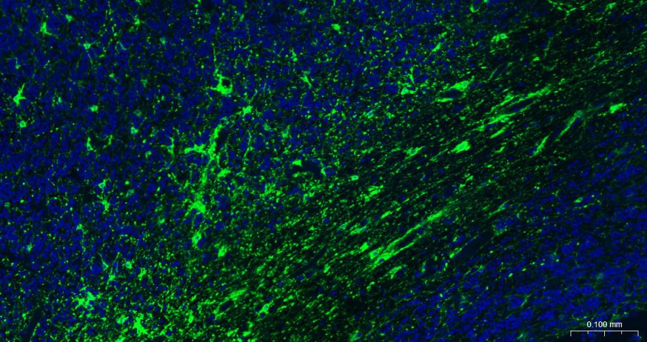 胶质纤维酸性蛋白重组兔单抗