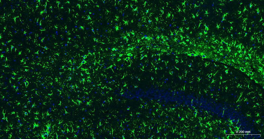 胶质纤维酸性蛋白重组兔单抗