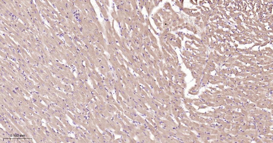 鸟苷酸环化酶β1重组兔单抗
