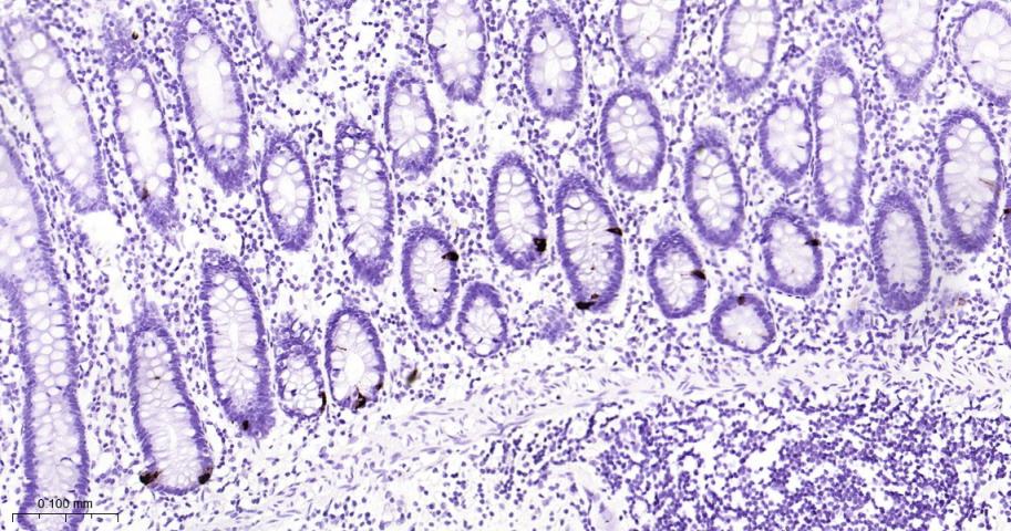 嗜铬粒素A重组兔单抗