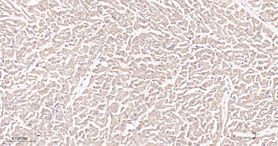 鸟苷酸环化酶β1重组兔单抗