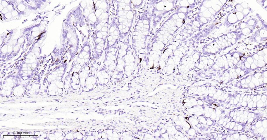 嗜铬粒素A重组兔单抗