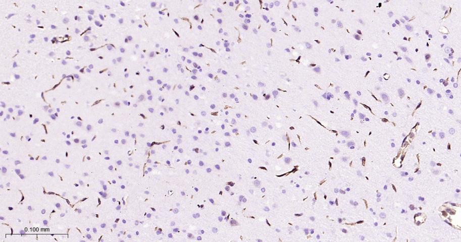 P-糖蛋白重组兔单克隆抗体