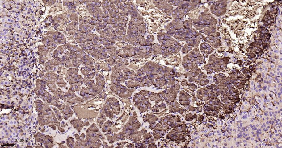 嗜铬粒素A重组兔单抗