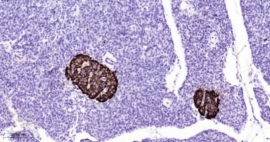嗜铬粒素A重组兔单抗