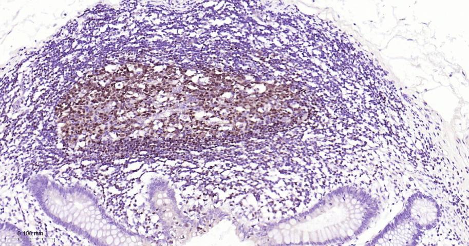 配对盒基因5重组兔单抗