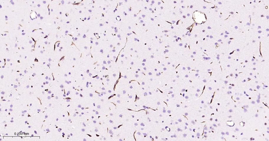 P-糖蛋白重组兔单克隆抗体
