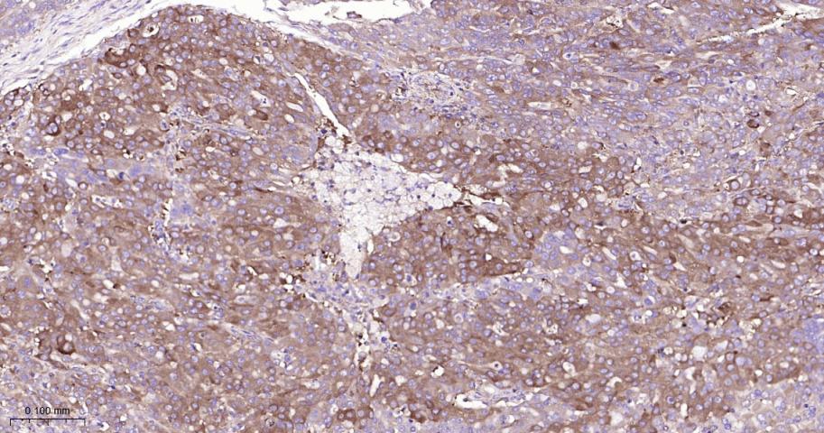 肺耐药相关蛋白重组兔单抗-bsm-61705R