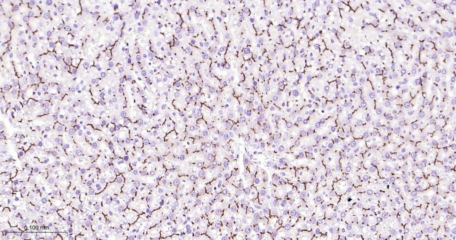 P-糖蛋白重组兔单克隆抗体