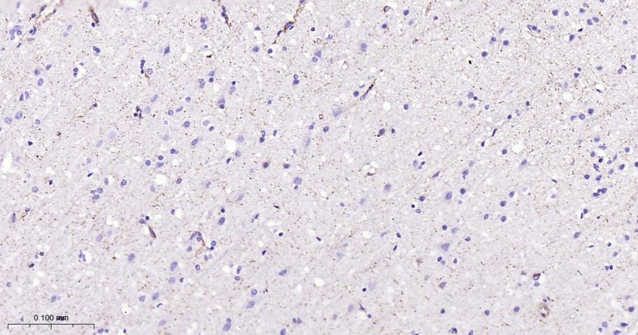 肺耐药相关蛋白重组兔单抗-bsm-61705R