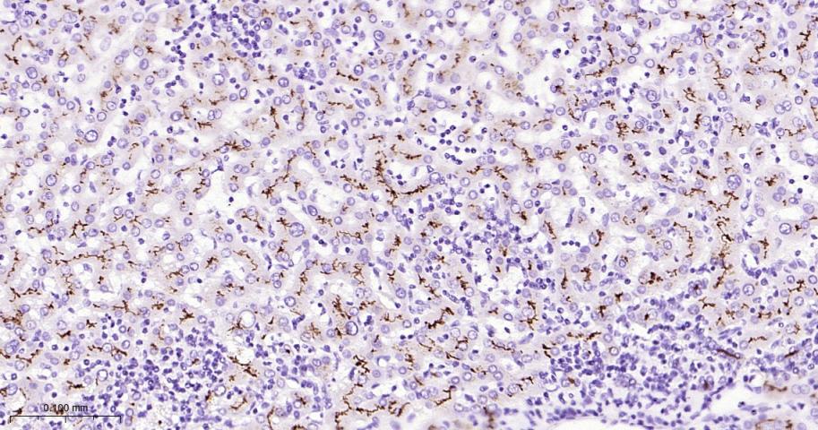 P-糖蛋白重组兔单克隆抗体