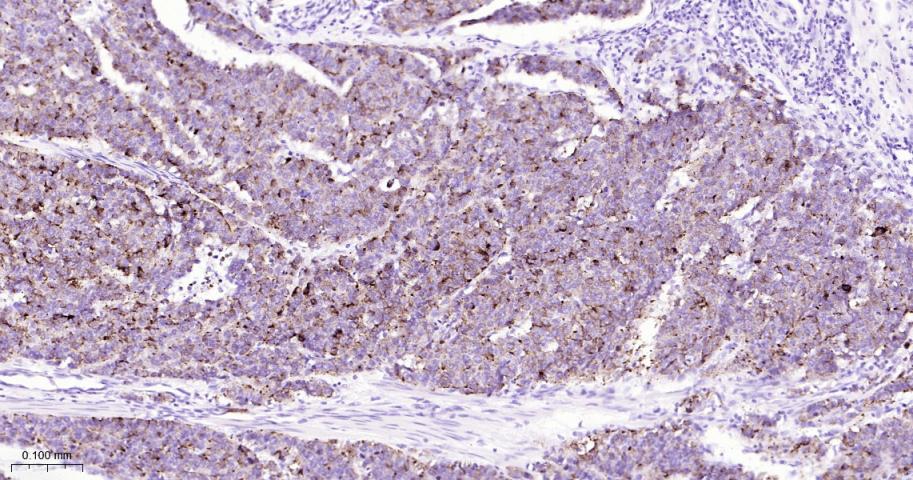 嗜铬粒素A重组兔单抗