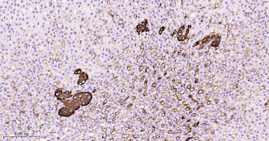 嗜铬粒素A重组兔单抗