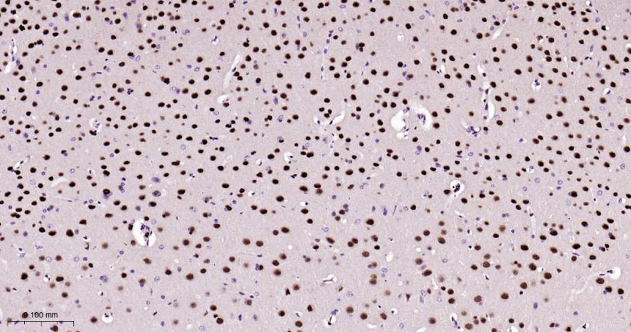 肌细胞增强因子2A/2C重组兔单抗