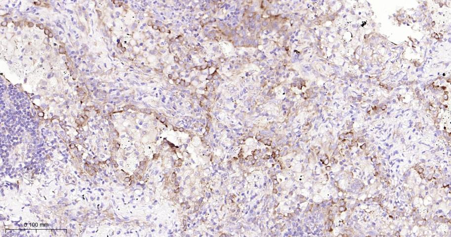 肺耐药相关蛋白重组兔单抗-bsm-61705R