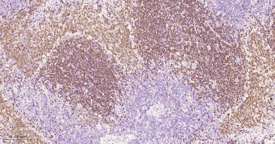 配对盒基因5重组兔单抗