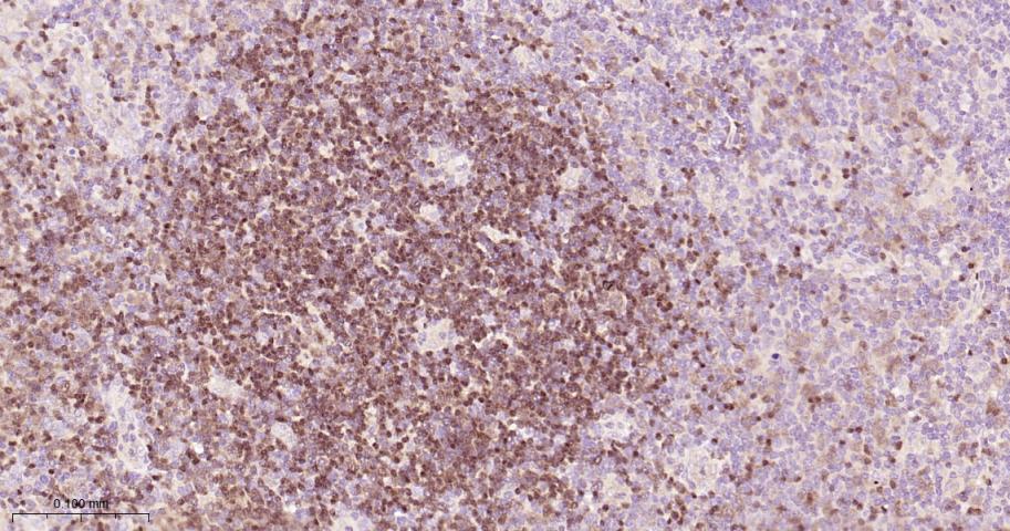 配对盒基因5重组兔单抗