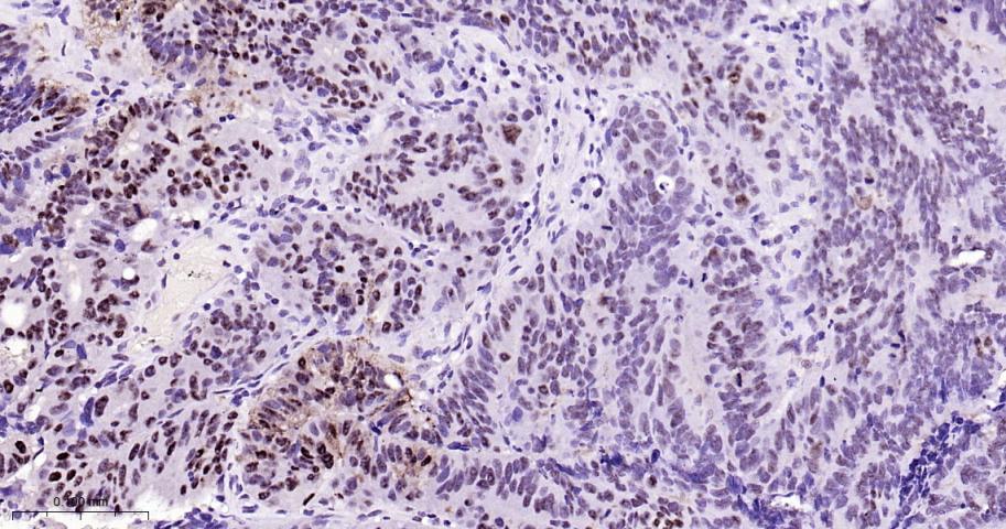 磷酸化信号转导和转录激活因子3单克隆抗体-bsm-33301M