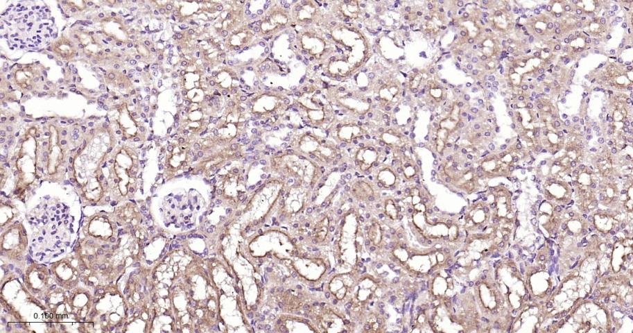 鸟苷酸环化酶β1重组兔单抗