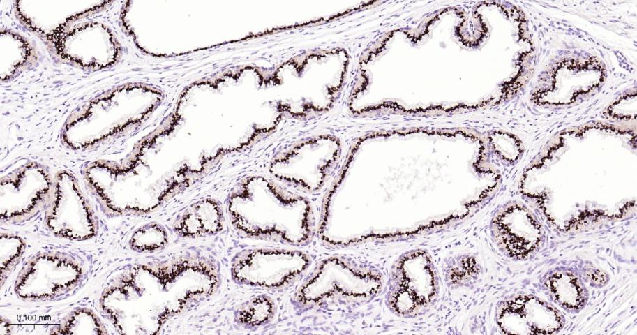 SLC45A3 Recombinant Rabbit mAb (一抗) - IHC-P,IHC-F,IF | Bioss