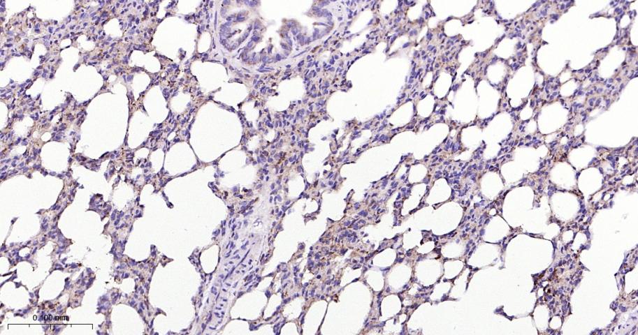 肺耐药相关蛋白重组兔单抗-bsm-61705R