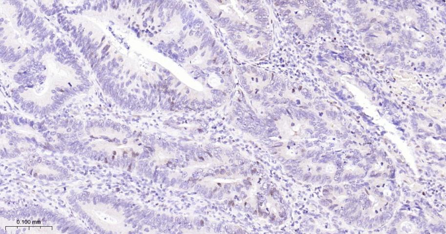 O6甲基鸟嘌呤DNA甲基转移酶重组兔单抗
