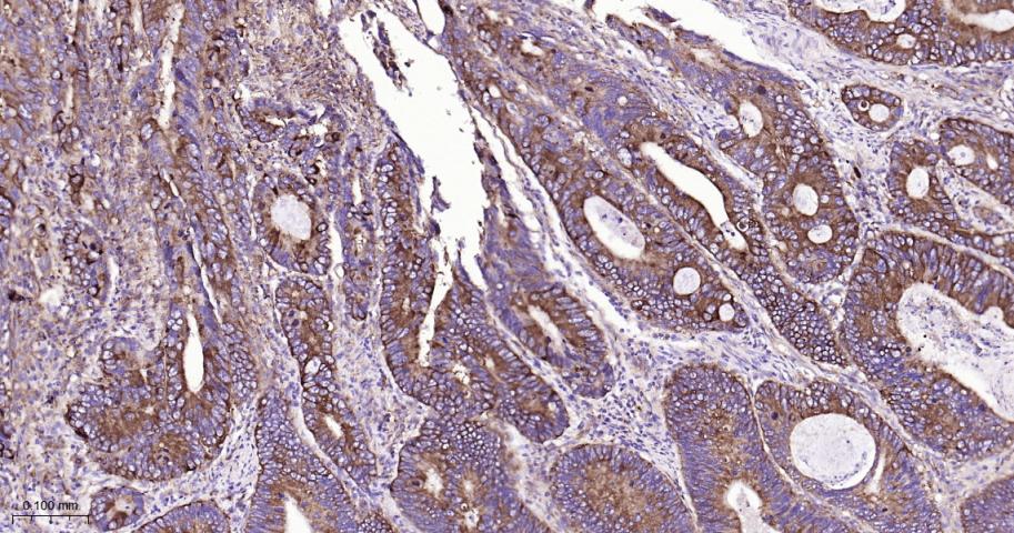 肺耐药相关蛋白重组兔单抗-bsm-61705R