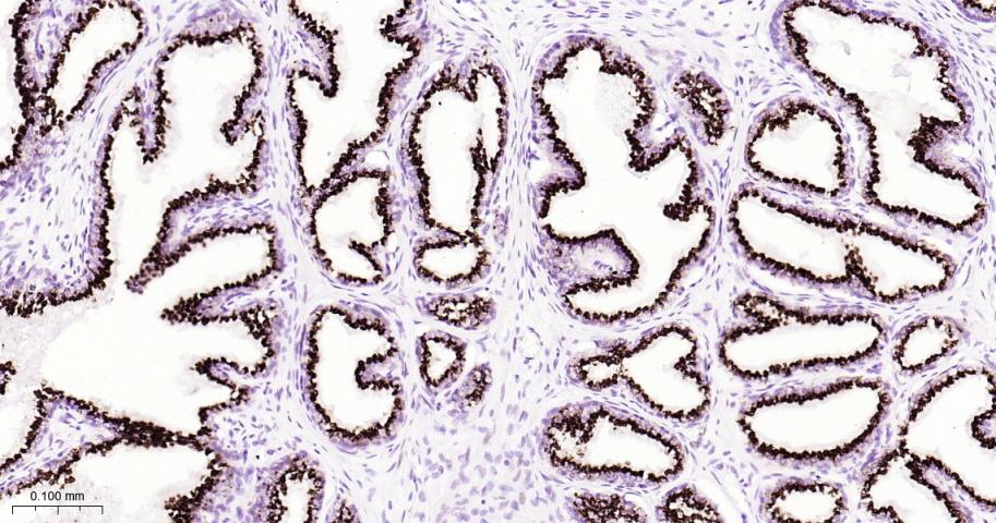 前列腺癌相关蛋白6重组兔单抗-bsm-62496R