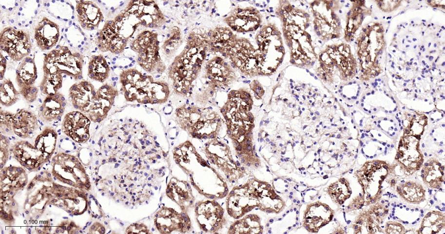 肺耐药相关蛋白重组兔单抗-bsm-61705R