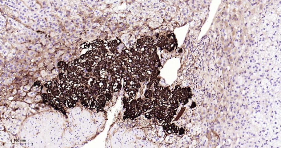 嗜铬粒素A重组兔单抗