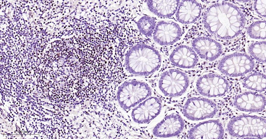 肌细胞增强因子2A/2C重组兔单抗