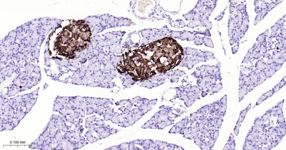 嗜铬粒素A重组兔单抗