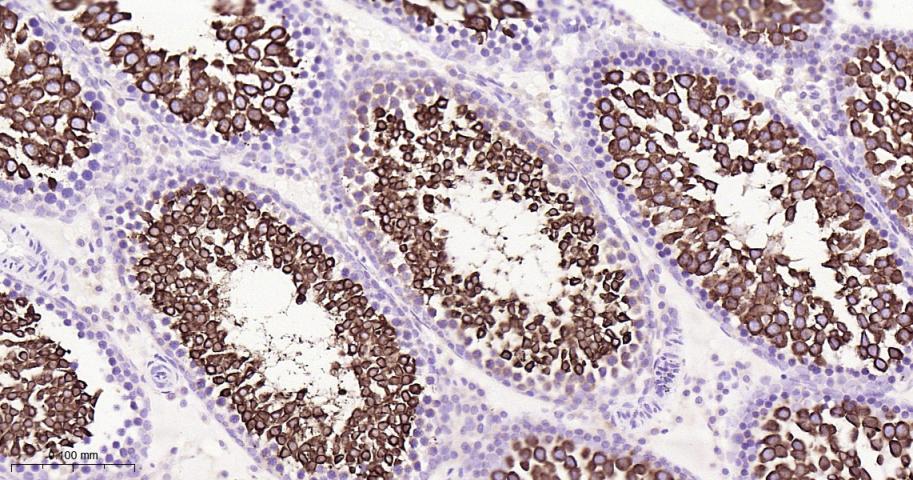 核因子2相关因子2抗体-bs-1074R