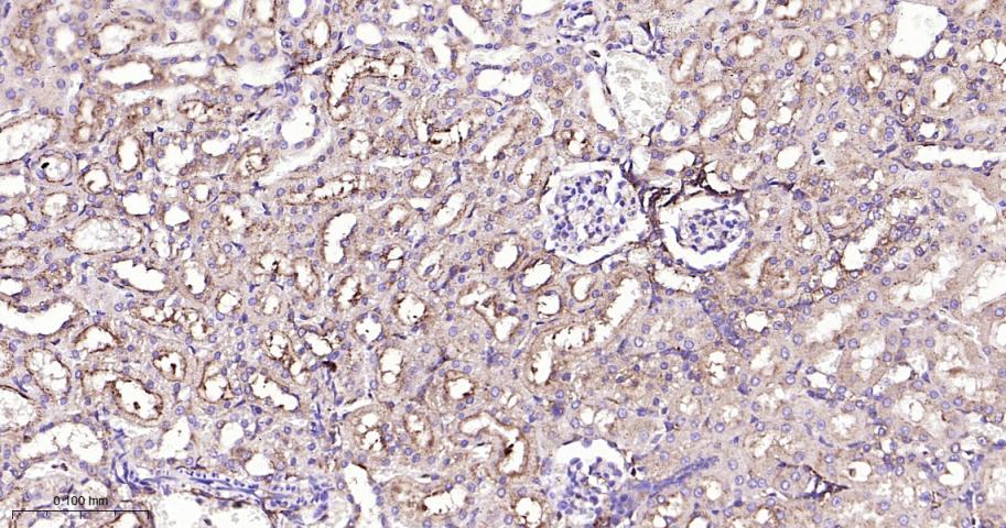 肺耐药相关蛋白重组兔单抗-bsm-61705R