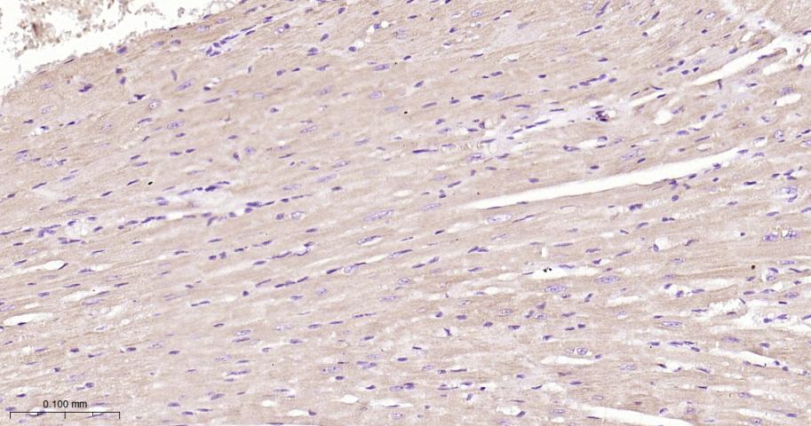鸟苷酸环化酶β1重组兔单抗