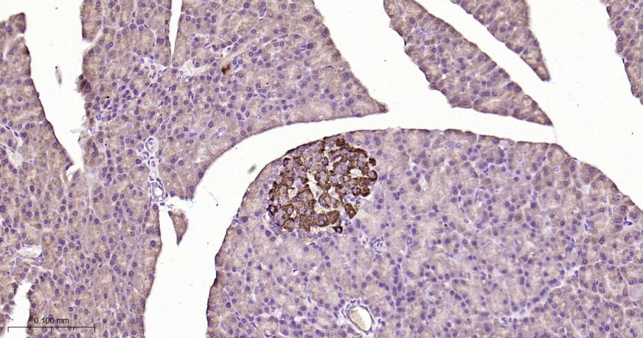 鸟苷酸环化酶β1重组兔单抗