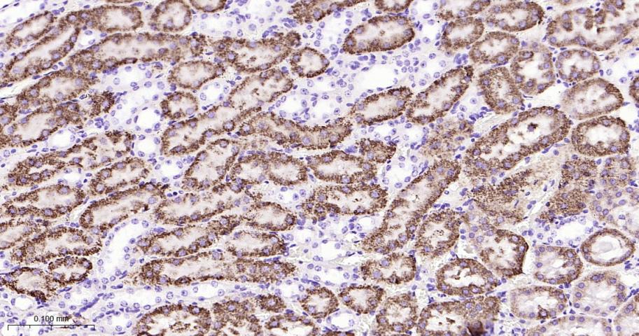P-糖蛋白重组兔单克隆抗体