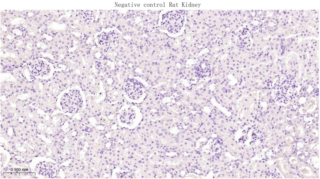 配对盒基因5重组兔单抗