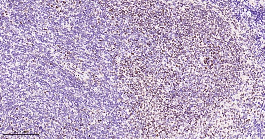 肌细胞增强因子2A/2C重组兔单抗