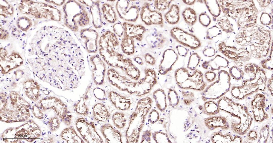 鸟苷酸环化酶β1重组兔单抗