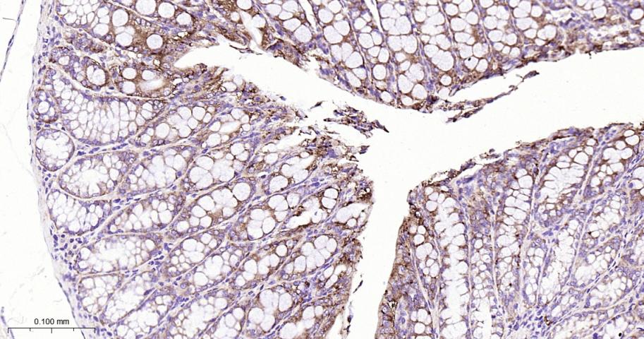 肺耐药相关蛋白重组兔单抗-bsm-61705R