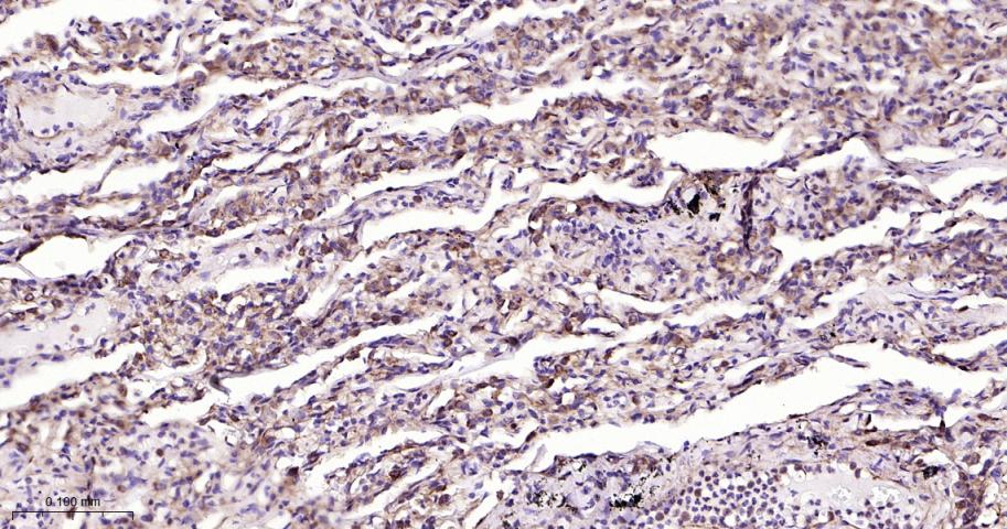 肺耐药相关蛋白重组兔单抗-bsm-61705R